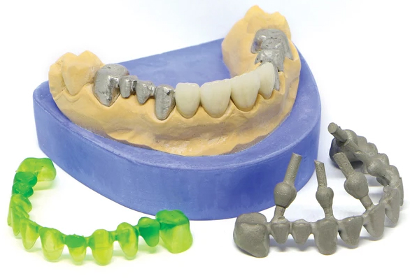 dental casting